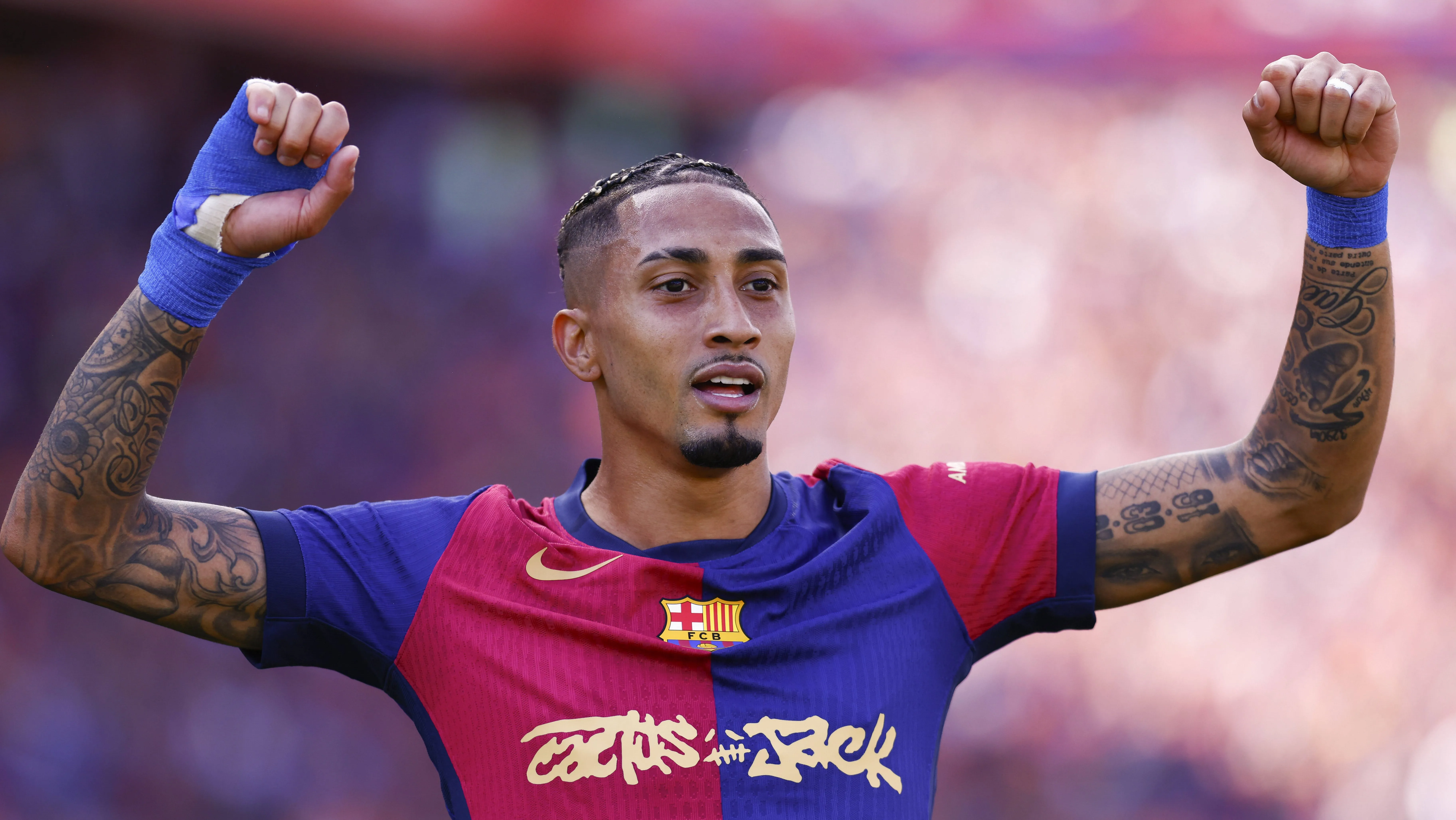 Por que jogadores do Barcelona usam bandagens nas m&atilde;os