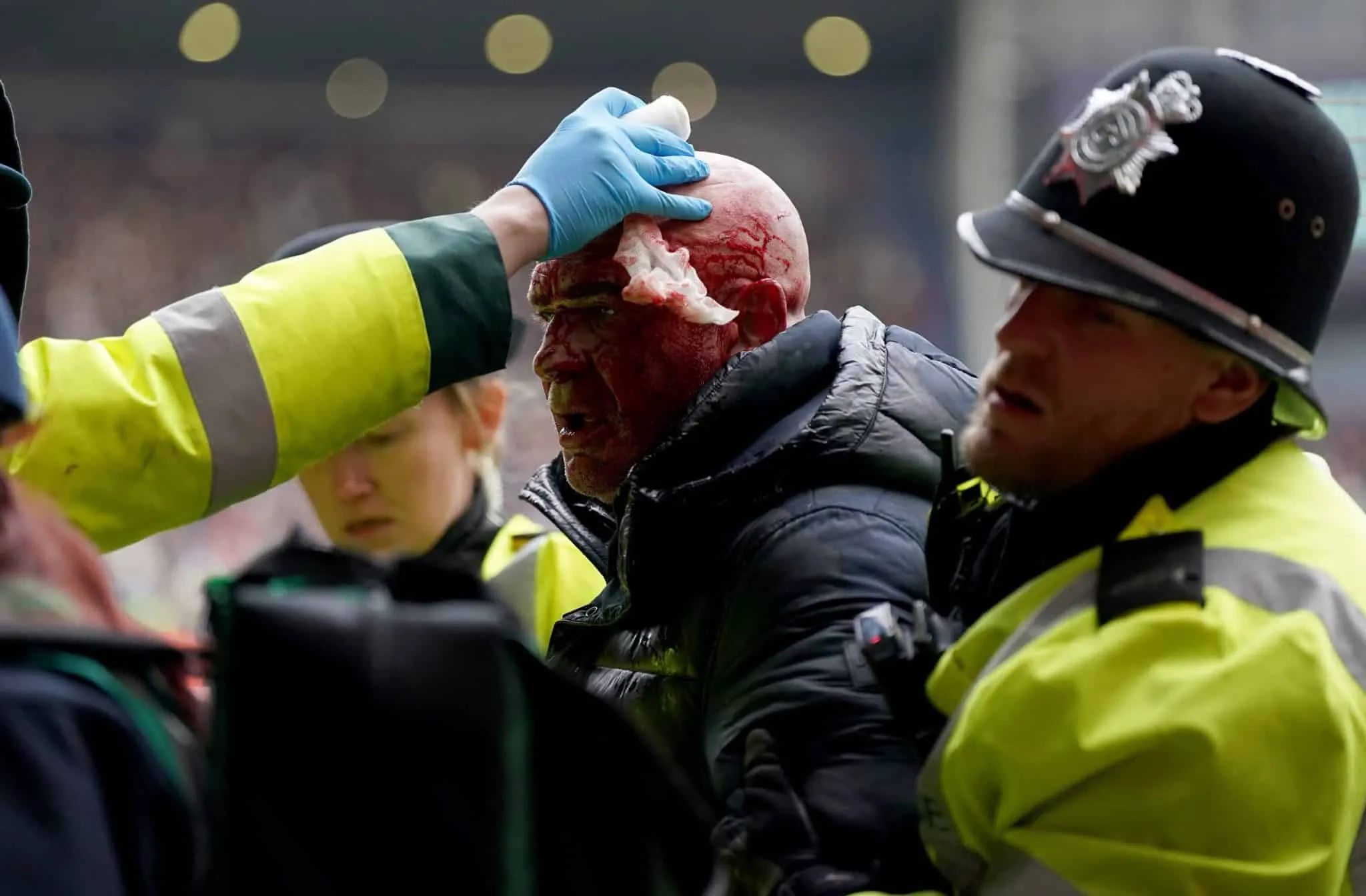 Gol de brasileiro desata confus&atilde;o nas arquibancadas que interrompe cl&aacute;ssico na Copa da Inglaterra