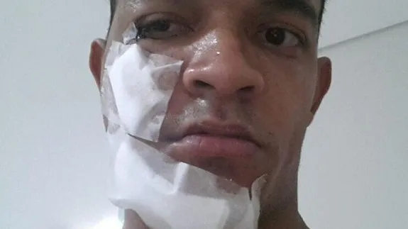 Atacante do Oeste traz a marca da viol&ecirc;ncia na S&eacute;rie B