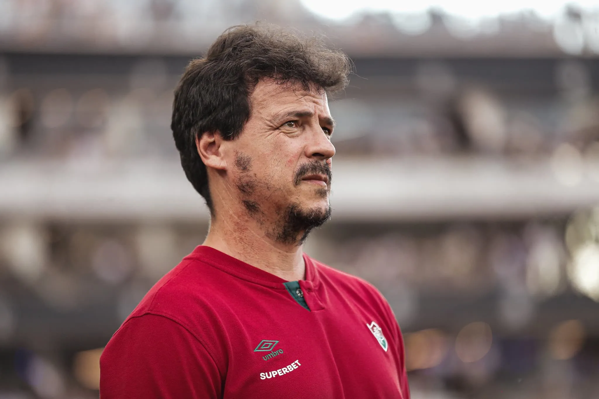 O motivo por tr&aacute;s da mudan&ccedil;a de tom de Fernando Diniz no Fluminense