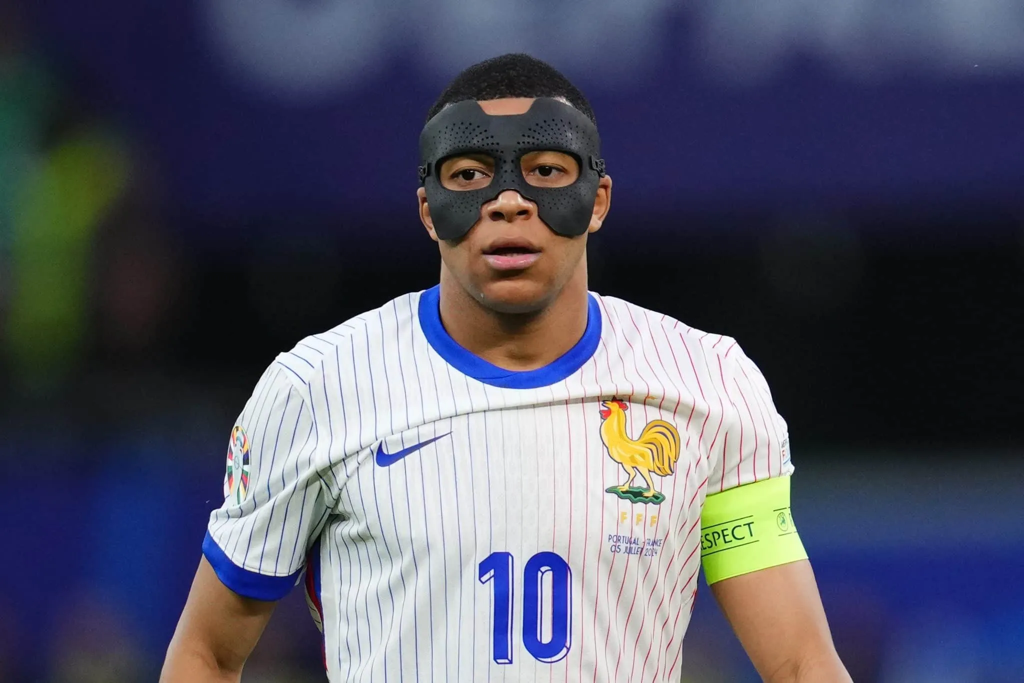 Poss&iacute;vel cirurgia no nariz de Mbapp&eacute; pode atrasar estreia no Real Madrid?