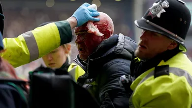 Gol de brasileiro desata confus&atilde;o nas arquibancadas que interrompe cl&aacute;ssico na Copa da Inglaterra