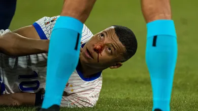 Mbapp&eacute; fratura o nariz e Federa&ccedil;&atilde;o Francesa anuncia decis&atilde;o sobre o jogador