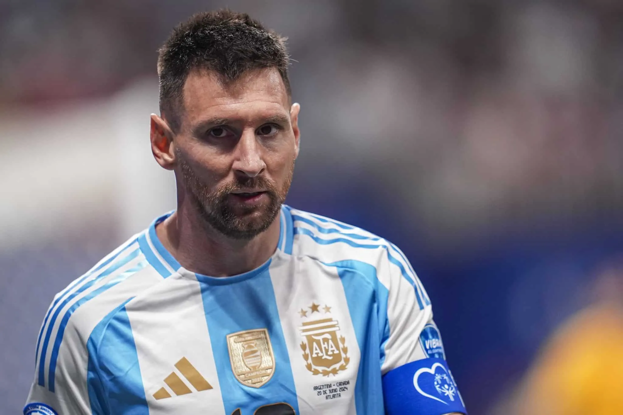 Padr&atilde;o Conmebol de qualidade? Argentina detona est&aacute;dio da abertura da Copa Am&eacute;rica